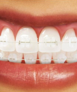 Archi Nichel Titanio Estetici Inferiore - Spessore 012 - Confezione da 10 pezzi